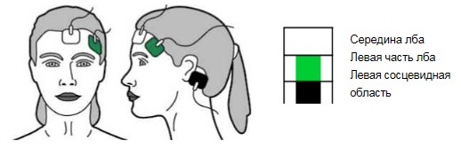 Электроды ЭЭГ